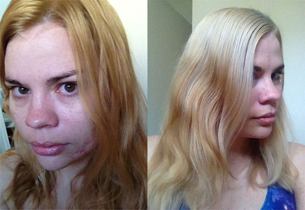 L -> R After first bleach, and after second bleach and toning